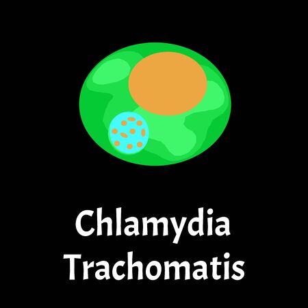 Chlamydia trachomatis. Bacterial infections Chlamydiosis. Sexually transmitted diseases. Infographics. Vector illustration on isolated background.のイラスト素材