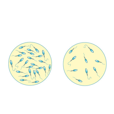Low sperm count in seminal fluid. Low abundance of sperm in the ejaculate. Male infertility...