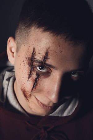 Teenage boy with wounds on face. Bullying and harassment.の写真素材