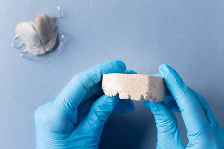 plaster cast of childs jaw in the hands of dentist. pediatric dentistry