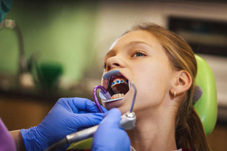 The little girl is at the dentist. She sits in the dentist's chair and the dentist sets braces on...