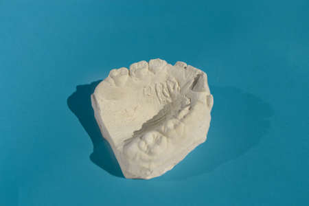 Dental model plaster cast or mould human jaws prothetic on blue background. High quality photoの写真素材