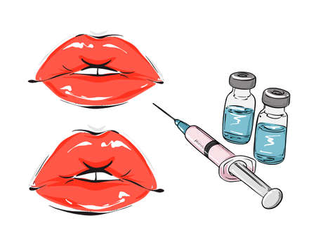 Medical glass bottles syringe lips implants infographic , lip fillers implants plastic syrgery vector  iconのイラスト素材