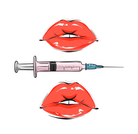 Lip filler procedure Beauty injection vector illustration Glamour fashion  art facial medical surgery treatment  vectorのイラスト素材