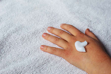 Red spots on the skin of the child's hands.children's allergy.selective focus.natureの写真素材