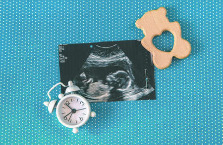 Ultrasound picture of a baby photograph. selective focus. Nature.の写真素材