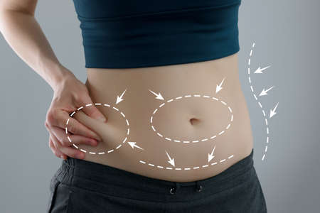 Skinny fat woman figure in fitness clothes touches stomach. Abdominal fat and diet concept. Massaging marks.の写真素材