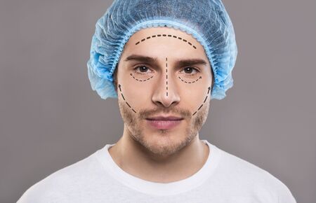 Handsome man in medical hat with pencil marks on skin for cosmetic surgery, ready for operation. Aesthetic Cosmetology conceptの写真素材