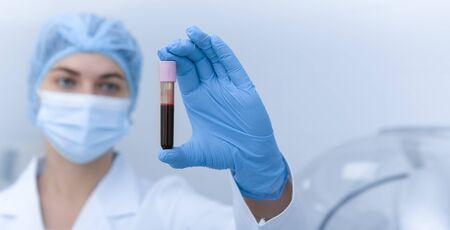 Close up of blood analysis in test tube, blurred medical woman in gloves, panorama, copy space