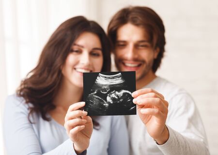 Happy young couple looking at sonography picture of their baby, selective focus on ultrasound scan in their handsの写真素材