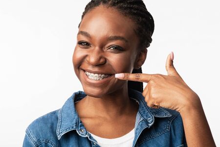 Cheerful African Girl In Dental Braces Pointing Finger At Smile And Teeth With Brackets Over White...