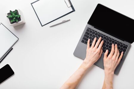 Female hands with vitiligo working on modern laptop. Office desktop on white background, blank...