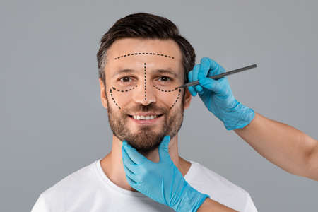 Handsome man with pencil marks on skin for cosmetic surgery, ready for operation. Aesthetic Cosmetology concept. Plastic surgeon applying marks on smiling man face before surgery, grey backgroundの写真素材