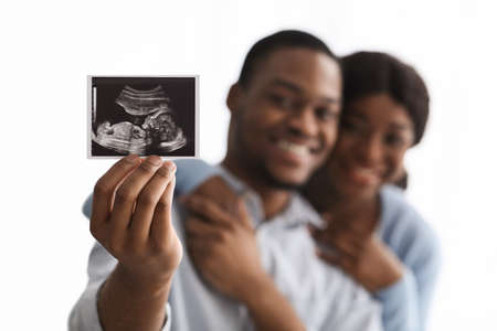 Closeup of black and white baby sonogram in happy hugging black couple hands, white background. Selective focus on ultrasound image, emotional african american family sharing their happinessの写真素材