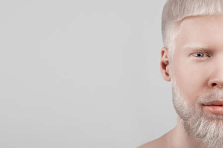 Half face portrait of albino guy with pale skin and white hair over light grey background, free spaceの写真素材