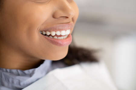 Teeth Whitening Concept. Closeup Of Beautiful Young African American Woman Widely Smilingの写真素材