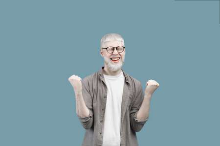 Overjoyed albino guy screaming in excitement, gesturing YES with both hands on turquoise studio backgroundの写真素材