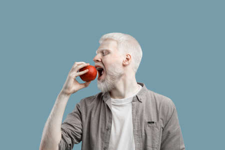 Eat fruits. Young albino man biting fresh red apple, standing over turquoise studio backgroundの写真素材