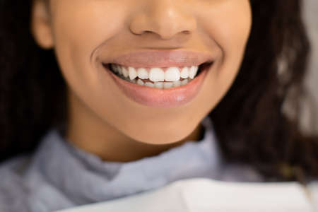 Closeup Of Unrecognizable Black Lady Widely Smiling With Her Perfect White Teethの写真素材