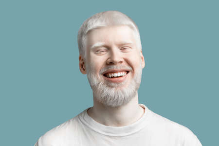 Portrait of happy bearded albino man with pale skin and white hair smiling to camera on turquoise backgroundの写真素材
