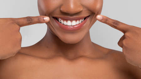 Smiling millennial african american female pointing fingers at perfect snow white smileの写真素材