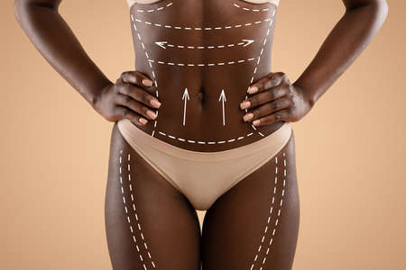 Cropped of african american woman in underwear before surgeryの写真素材