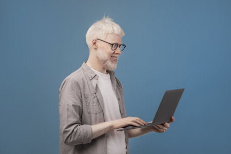 Happy albino freelancer guy working online on laptop, holding computer while browsing internet, blue...