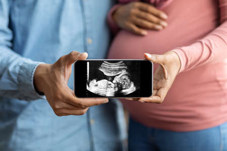 Black pregnant couple holding smartphone with baby ultrasound image, closeup