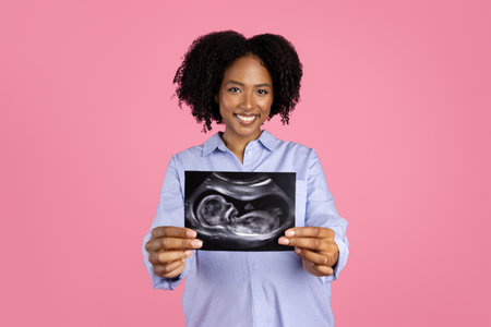 Smiling young pregnant african american curly lady in casual with big belly show ultrasound shotの写真素材