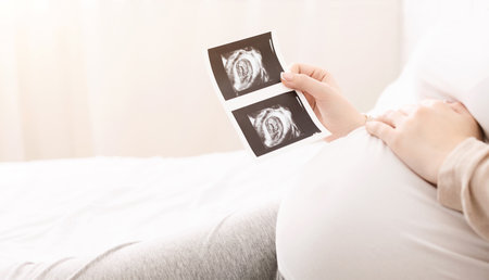 Pregnant woman holding ultrasound image lying in bedの写真素材