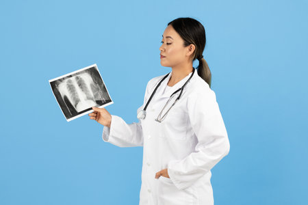 Medical professional examines chest X-ray against a blue background