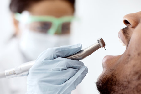 Black Dentist Doctor Lady Using Dental Drill For Male Patients Teeth Treatmentの写真素材