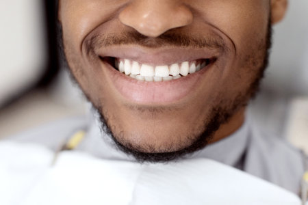 Unrecognizable Black Man Widely Smiling With His Perfect Healthy White Teeth, Closeupの写真素材