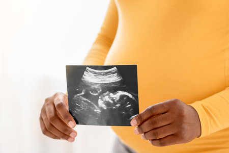 Unrecognizable pregnant woman holding ultrasound image of unborn childの写真素材