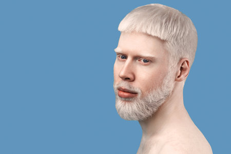 Carefree young albino guy with pale skin and white hair, posing to camera without shirt against turquoise backgroundの写真素材