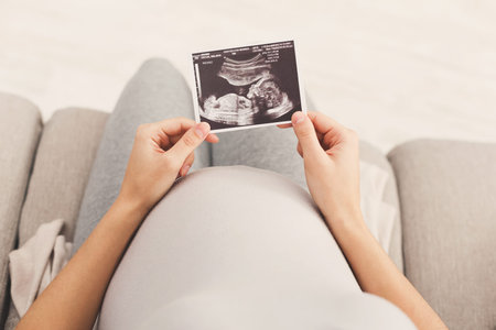 Expecting Parents Hold Ultrasound Image of Their Upcoming Baby During Quiet Moment at Home