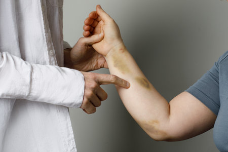 Bruise and injury from a collision, impact or fall. Woman with bruised skin and doctorの写真素材