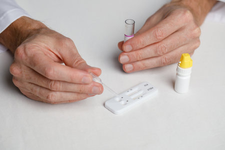 Closeup of veterinarian doctor with test for detection of feline leukemia virus and feline...