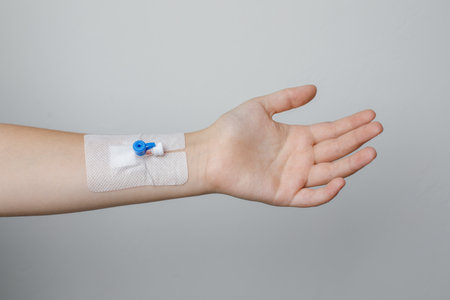 Female hand with Peripheral venous catheter on white backgroundの写真素材