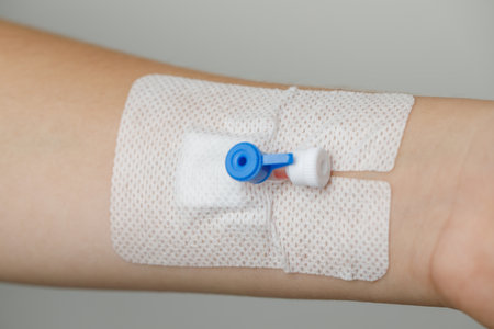 Medical device. Peripheral Catheter for Multiday Therapyの写真素材