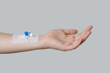 Human hand with Peripheral venous catheter on white backgroundの写真素材