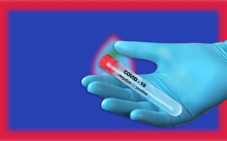 Testing for presence of coronavirus. Tube containing a swab sample that has tested positive for...