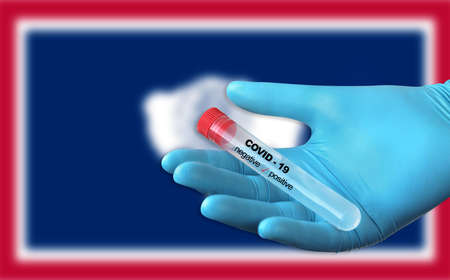 Testing for presence of coronavirus. Tube containing a swab sample that has tested positive for...