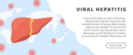 Concept of hepatitis A, B, C, D, cirrhosis, world hepatitis day. Web Horizontal Banner Template with...