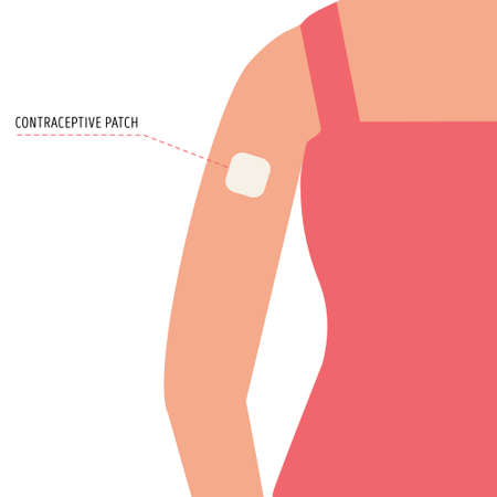 Contraception method. Vector flat female arm with contraceptive patch. Birth control for women and pregnancy prevention. Illustration.のイラスト素材