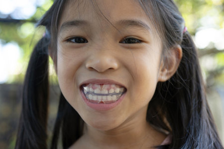 EF Line orthodontic tool for children teeth with cheek retractor, primary teeth, baby teeth, or milk teeth and plaque, tartar for healthy oralの写真素材