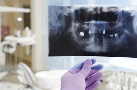 Doctor holding and looking at dental x-ray