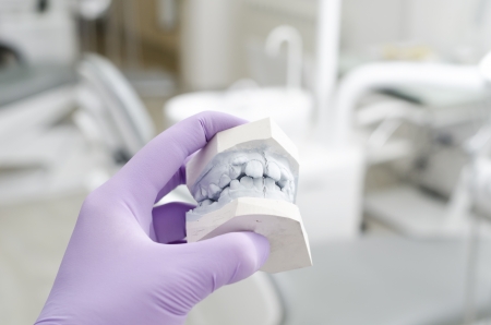 Hand of dentist holding dental gypsum models