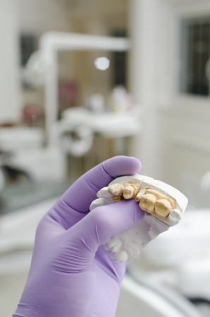 Hand of dentist holding dental gypsum modelsの写真素材