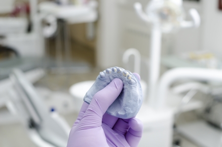 Hand of dentist holding dental gypsum modelsの写真素材